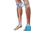 膝の痛み　鵞足炎