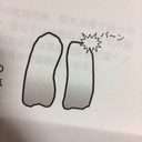 肺に穴があきそう