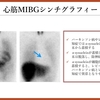 パーキンソン病を科学する