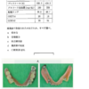 114回　義歯振り返り　口腔機能低下編