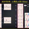 ECG-338：answer (1/2)