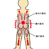 腰痛は腹筋や背筋を鍛えても良くなりません