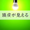 【薄毛】蛍光灯の光で頭皮が見えるのはハゲなのか問題