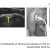 超音波画像診断装置を用いた上腕二頭筋長頭腱の評価