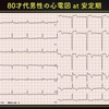 ECG-212：answer-1/2:俯瞰的に読む