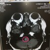 ❲退院後2度目の造影MRI検査❳