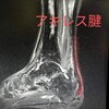 ★治療2ヶ月と4日①  2回目のMRI！