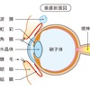 虹彩後癒着の手術　１