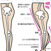 ストレッチやり過ぎ膝痛。