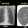 在宅ワーク。喫煙減った？増えた？