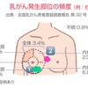 （健忘録）ステージ、タイプ、そしてウィッグのリンク