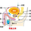 淋菌性精巣上体炎(りんきんせい・せいそう・じょうたいえん)～男性用