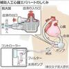 日本製の人工心臓、生存率が移植並みの好成績の事。
