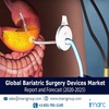 Bariatric Surgery Devices Market Research Report, Market Share, Size, Trends, Forecast and Analysis of Key players 2025