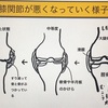 変形性膝関節症　対策