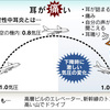 航空性中耳炎