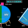 コラム-082：ACS  RCAとLCX 責任病変の違いを、また考えてみましょう 1/2