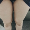 医療ダイエットの【ディオクリニック】体験レビュー③