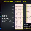 ECG-350：answer