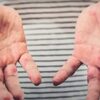 米国で麻疹が再び猛威を振るい、感染者数が1,000人を超える
