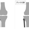 【正しい関節の位置】＝【正しい姿勢】