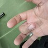 農作業し過ぎでばね指になったった