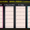 ECG-331：answer(2/3)