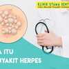 Muncul Lepuhan pada Kulit, Bisa Jadi Penyakit Herpes