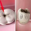 Hiểu rõ hơn về sâu răng và khi nào cần nhổ răng sâu?
