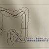 ポリープ切除から3日目、出血あり!!