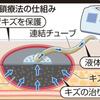 熱傷治療における局所陰圧閉鎖療法（NPWT)