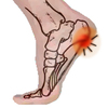 Heel Aches