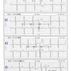 PVCを詳しく見てみる（その４  多源性VPC）