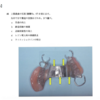 116回歯科医師国家試験【116C-46】義歯：ビーディング編