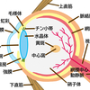 手術の説明　