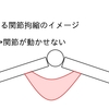 筋の「短縮」は拘縮の原因ではない