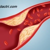 Cholesterol là gì tại sao nói cholesterol có hại cho hệ tim mạch