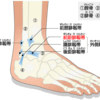 足首の痛みの原因となる「足関節捻挫」について整形外科医が解説してみました
