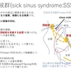 不整脈：徐脈：洞不全症候群(SSS)について　〜基本30〜