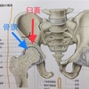 股関節の動き悪さからくる腰痛と対処法