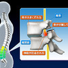 腰痛スパイラルから抜け出そう・その４（４/４）