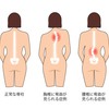 脊柱側彎症だと肩の高さ,腰の高さが違うらしい,プレス種目への影響