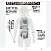 水毒は血の汚れ、冷えを伴う