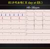 ECG-281：answer