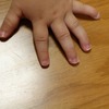 小さな手に備え付けの、恐るべき凶器