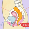 ４０代女性尿もれの原因は？治し方はあるの？