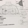 乳がん告知