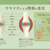 046【関節リウマチ】自己免疫疾患（その１）