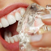 Cách chữa sâu răng hiệu quả thành công 100%