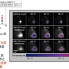 卒業生との発表論文２―近赤外蛍光寿命イメージングによる非接触温度測定